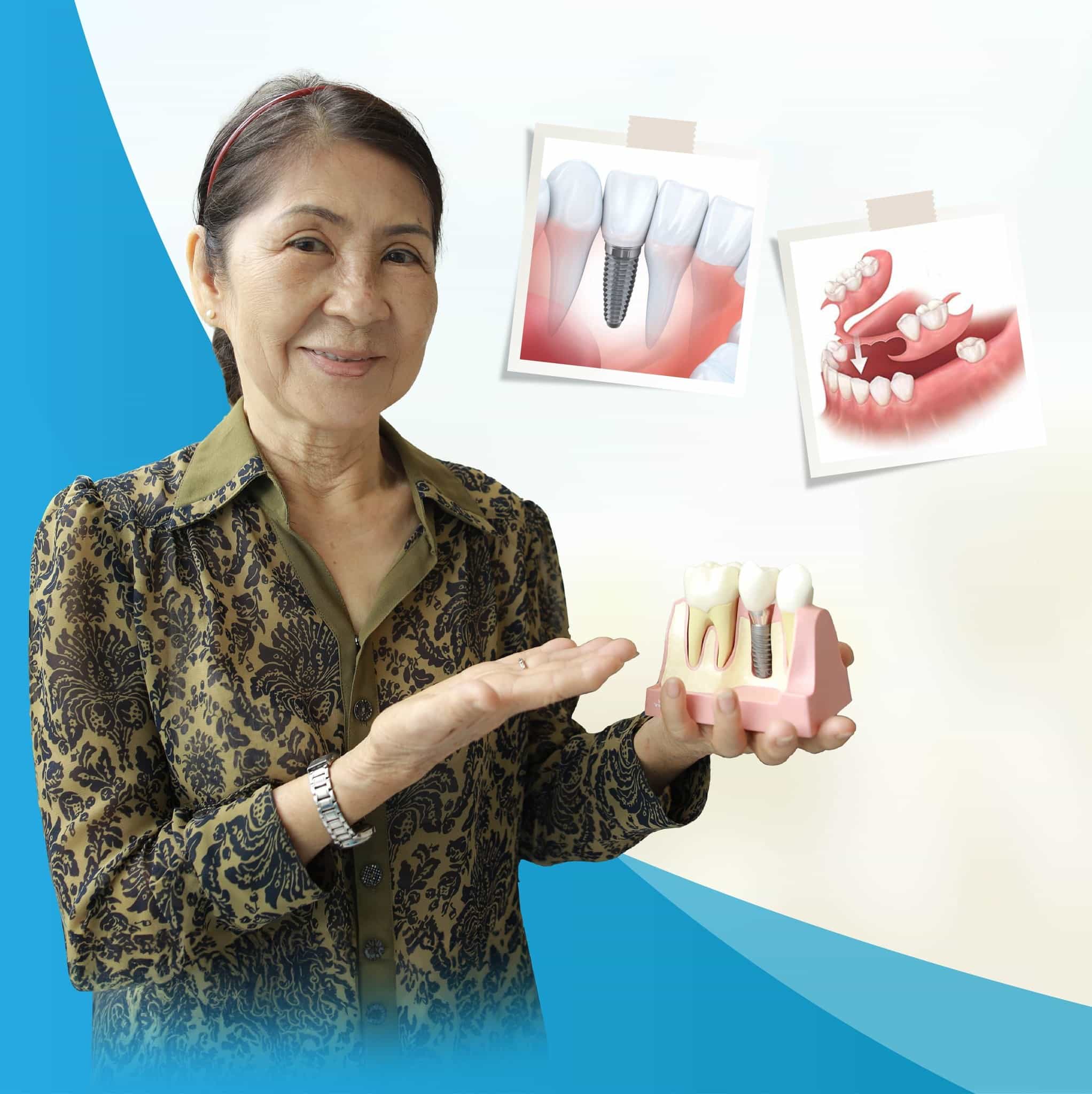 địa chỉ trồng răng implant uy tín tại tphcm