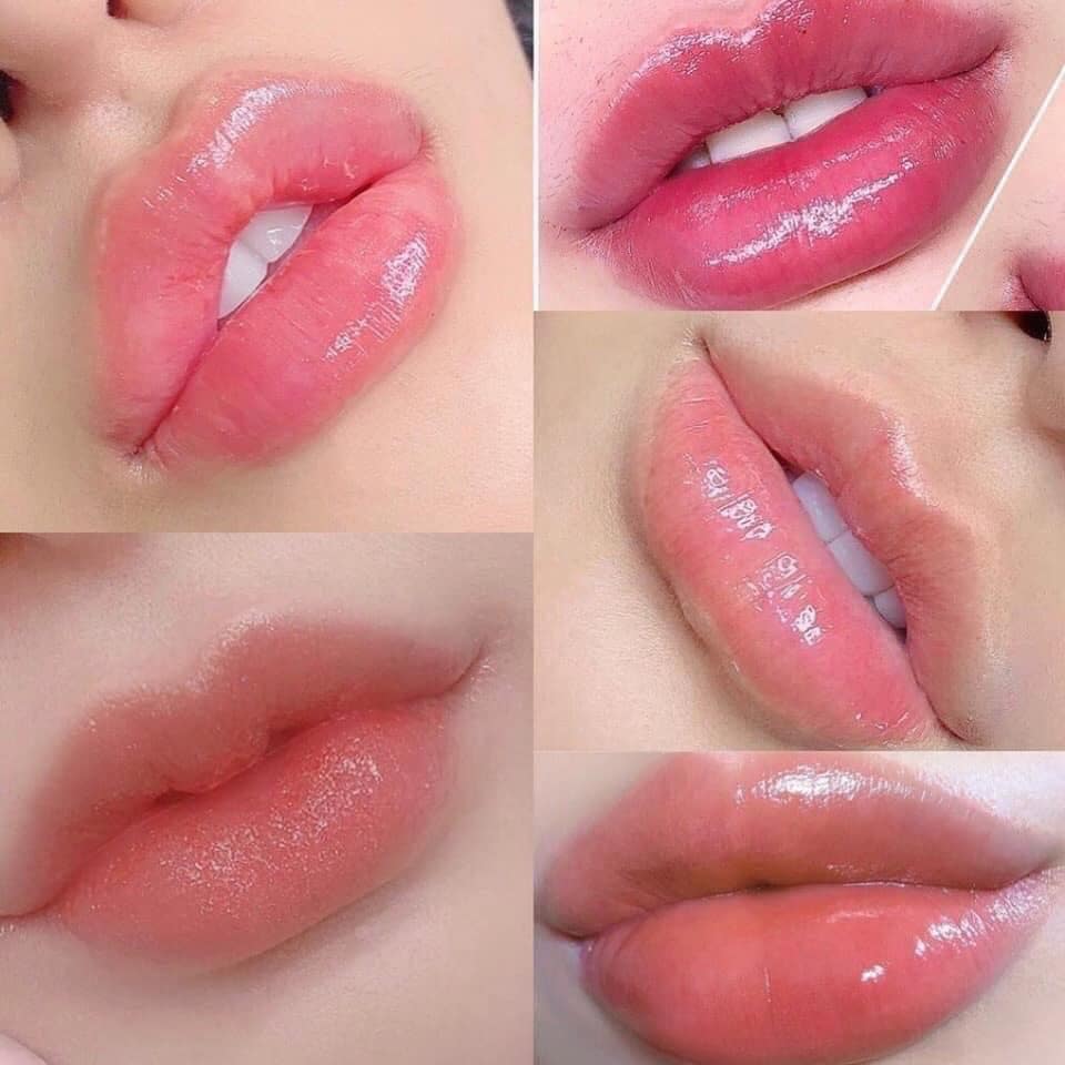 Thẩm Mỹ Viện Kiều Phương