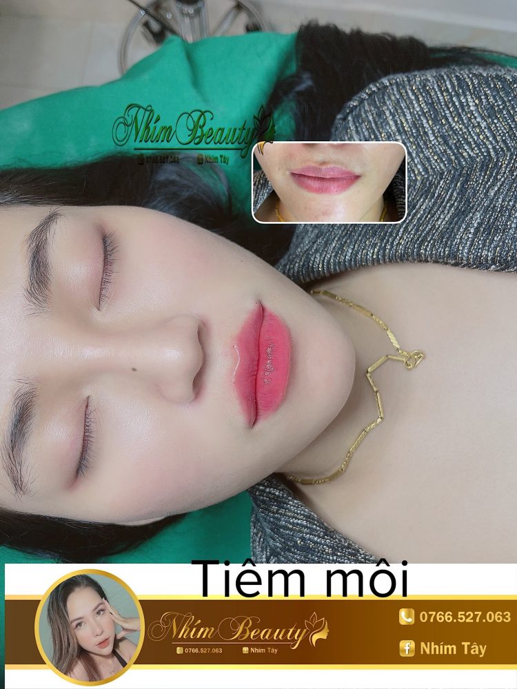 Dịch vụ tại Spa Nhím Beauty