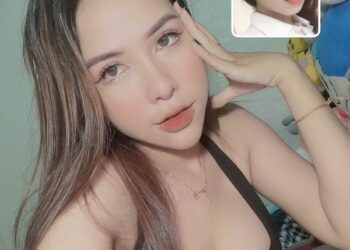 Tiêm filler đẹp Đà Nẵng