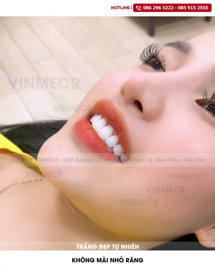 Nha Khoa Thẩm Mỹ Quốc Tế Bv Vinmecr