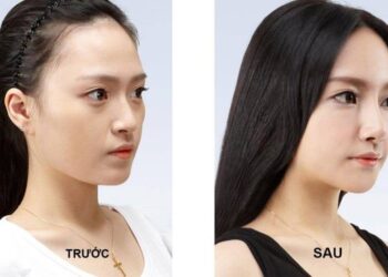 Top 20 Địa Chỉ Nâng Mũi Tại Hà Nội Uy Tín Mà Bạn Nên Biết