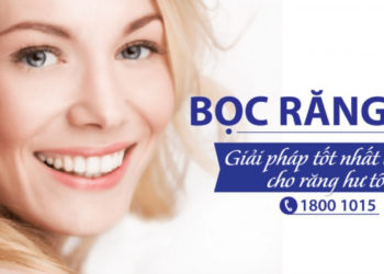 bọc răng sứ biên hòa