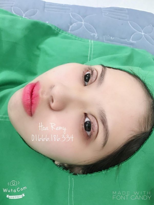 nhấn mí Cần Thơ