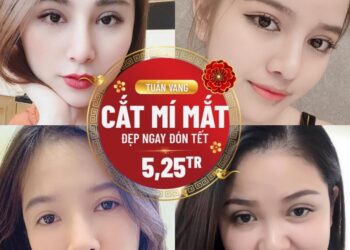 Nhấn mí Hải Phòng