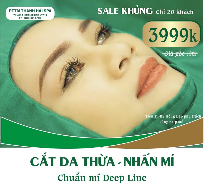 cắt mí Hải Phòng