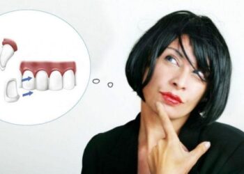 bọc răng sứ Hải Phòng