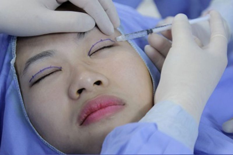 cắt mí Hải Phòng