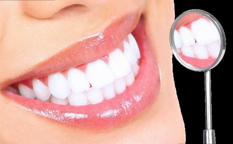 tẩy trắng răng TPHCM Nha Khoa Elite Dental