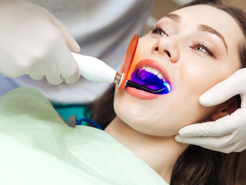 tẩy trắng răng TPHCM Nha Khoa Paris