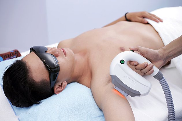 triệt lông cho nam giới ở tphcm