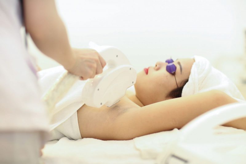 triệt lông tại hải phòng