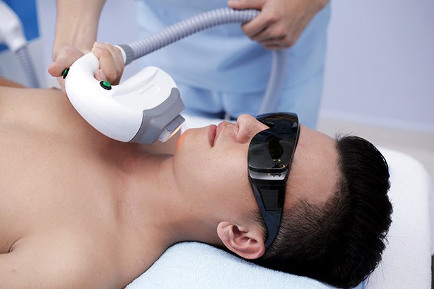 triệt lông cho nam giới ở tphcm