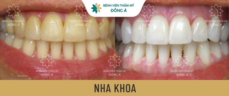 nha khoa đông á