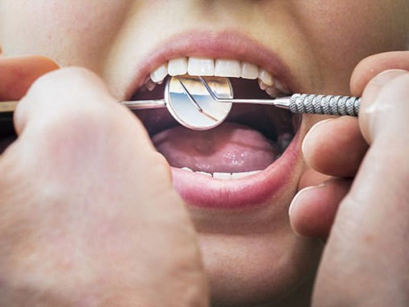 nhổ răng khôn Đà Nẵng nhổ răng khôn Đà Nẵng