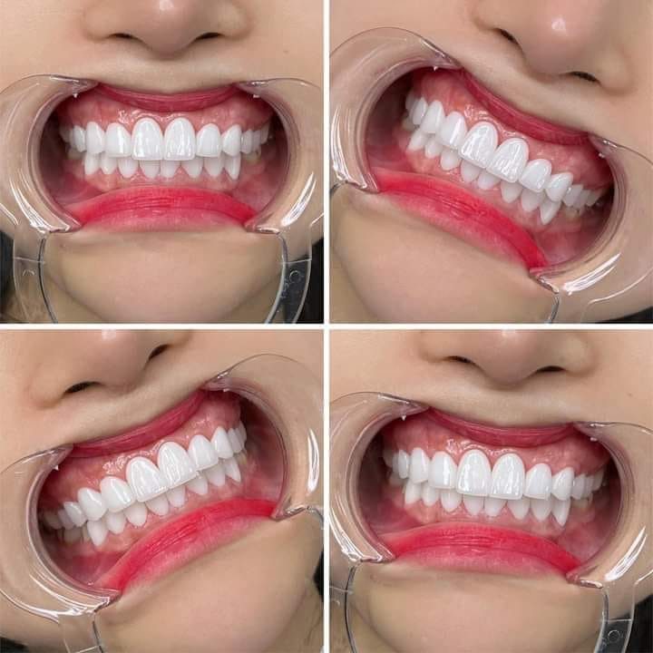 nha khoa Long Xuyên