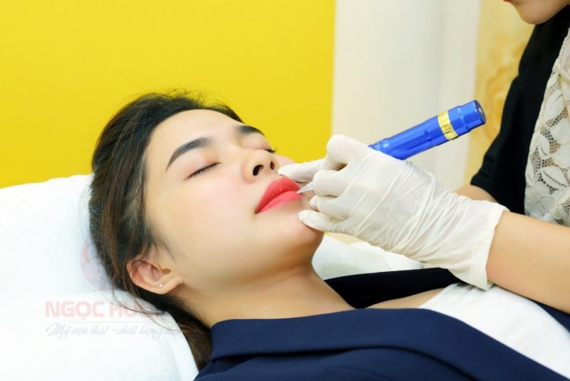 thẩm mỹ viện uy tín ở Mỹ Tho Ngọc Hường