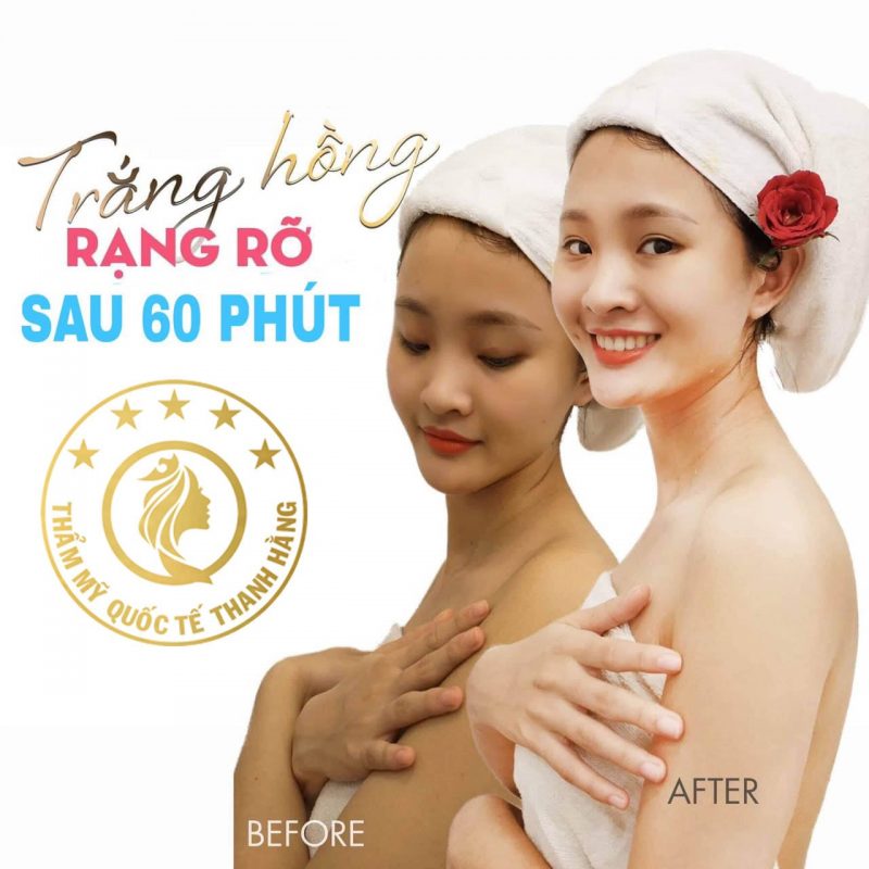thẩm mỹ viện uy tín ở Mỹ Tho thẩm mỹ viện uy tín ở Mỹ Tho