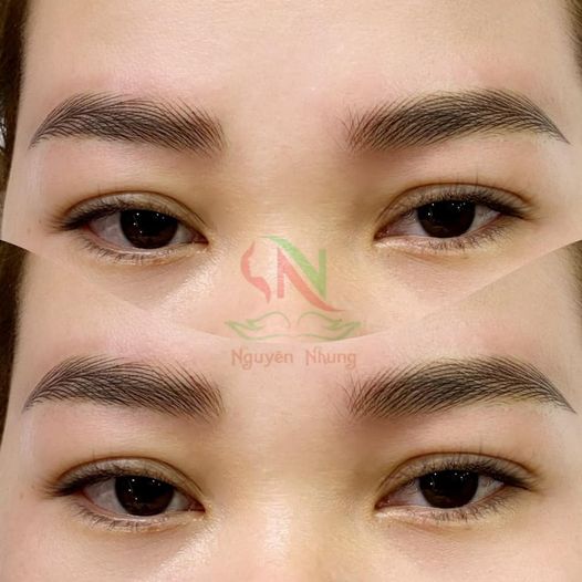 Thẩm Mỹ Viện Nguyên Nhung thẩm mỹ viện Tây Ninh