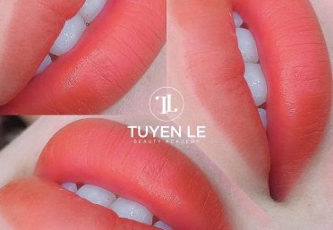Thẩm mỹ viện Tây Ninh thẩm mỹ viện Tây Ninh