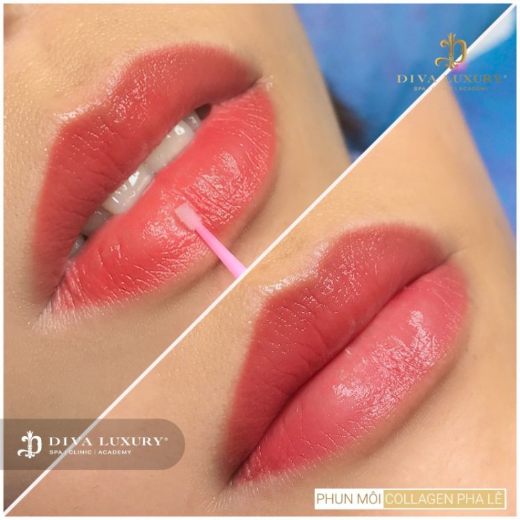 Viện Thẩm Mỹ Diva thẩm mỹ viện tây ninh