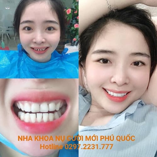 Nha khoa Phú Quốc nha khoa thẩm mỹ