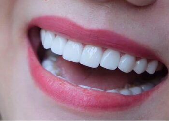 nha khoa phú quốc