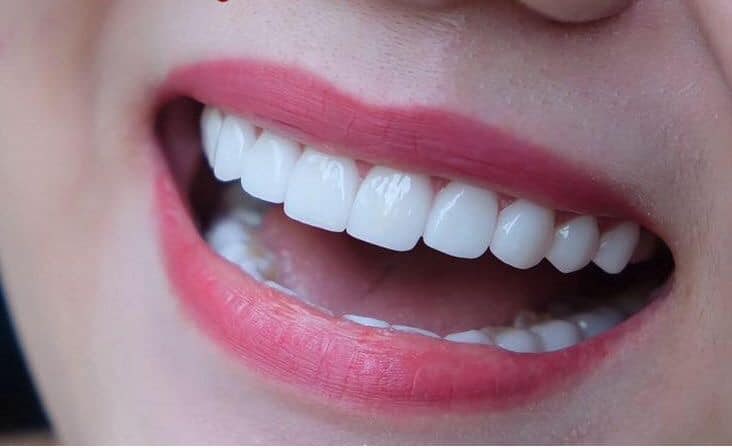 nha khoa phú quốc Klava Smart Dental