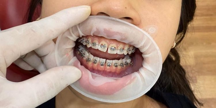 nha khoa phú quốc Trần Thanh Lâm