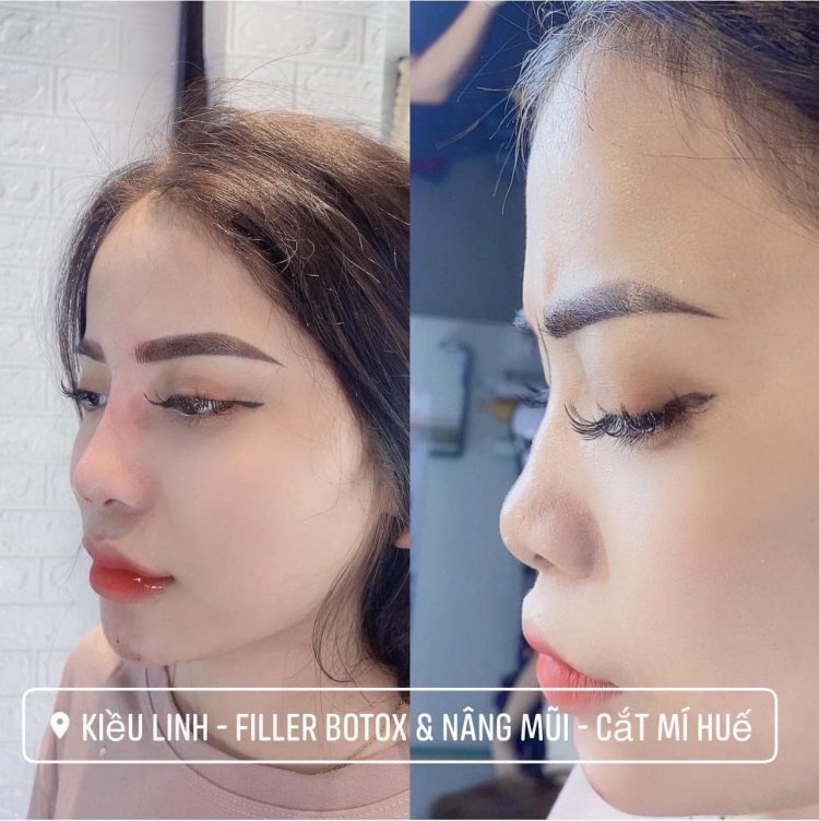 thẩm mỹ viện Kiều Linh