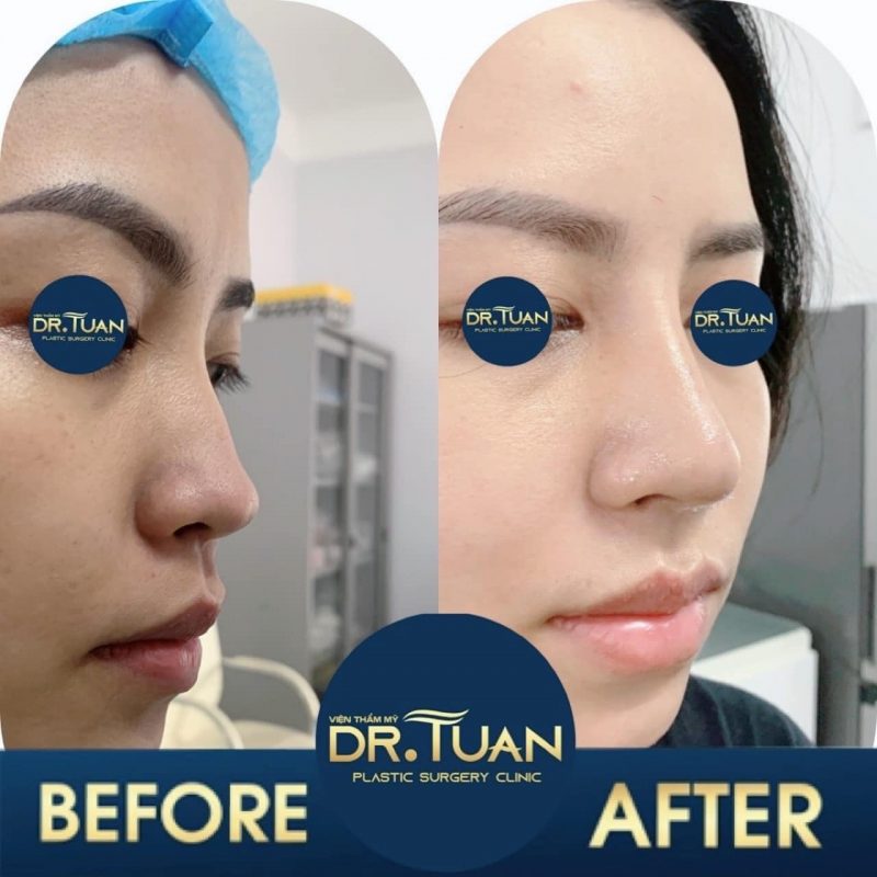 thẩm mỹ viện bác sĩ Tuấn
