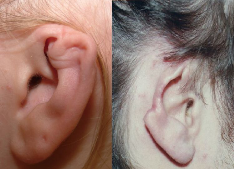 ngứa tai phải điềm gì ngứa tai phải điềm gì