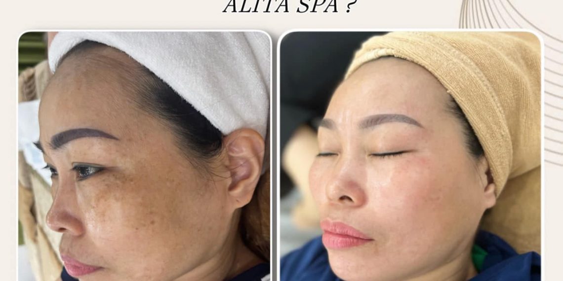 ALITA Spa