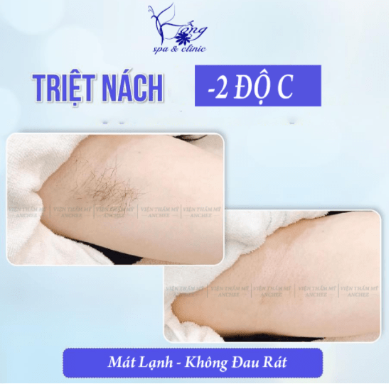 cách wax lông nách