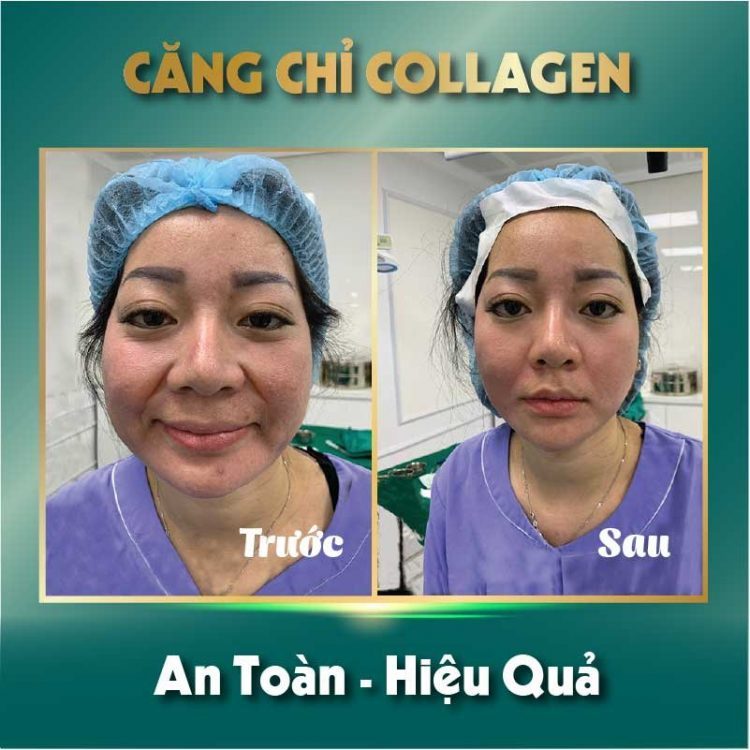 bống spa