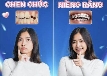 niềng răng trả góp Quy Nhơn