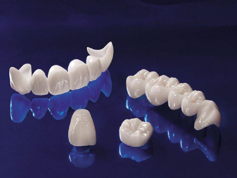 Bọc răng sứ Zirconia có tốt không Bọc răng sứ Zirconia có tốt không
