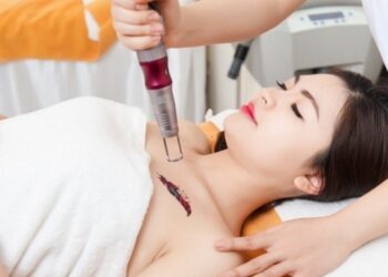 Xóa Hình Xăm Ở TPHCM