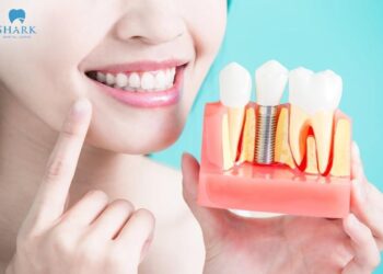 Trồng răng Implant giúp khắc phục hiệu quả những trường hợp mất 1 răng hoặc mất răng toàn hàm