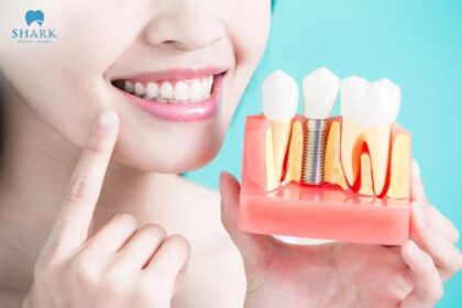 Cấy Ghép Implant Trồng răng Implant giúp khắc phục hiệu quả những trường hợp mất 1 răng hoặc mất răng toàn hàm