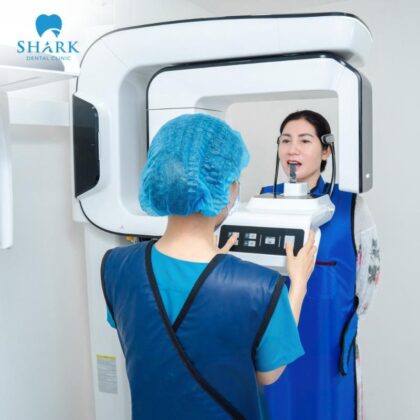 Cấy Ghép Implant Nha Khoa Shark ứng dụng công nghệ trồng răng Implant hiện đại, giúp khách hàng có những trải nghiệm hoàn hảo nhất