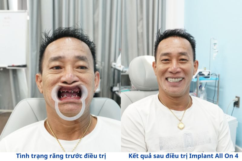 Nha Khoa SGC